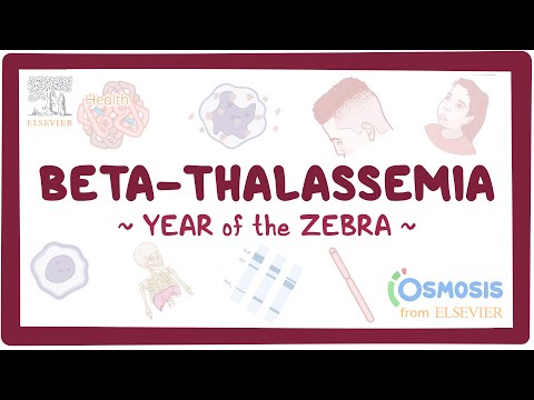 Achalasia Year of the Zebra