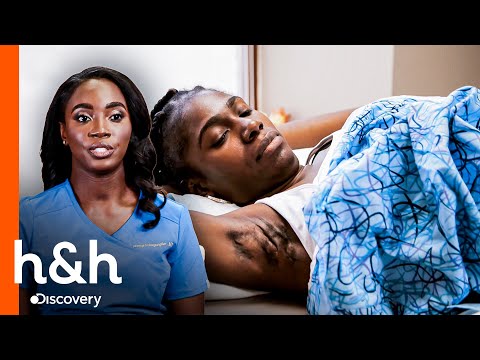 Tiene forúnculos en su axila y espalda | Dr. Mercy | Discovery H&H