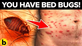 Rash Or Bite? Warning Signs You May Have Bed Bugs