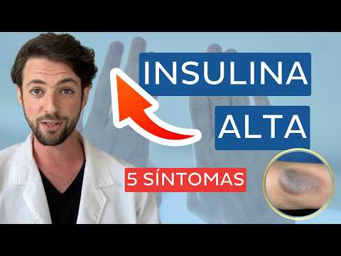 📈 HIGH INSULIN SYMPTOMS 🤯 you need to know