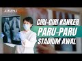 Apa Ciri Ciri Kanker Paru Paru Stadium Awal
