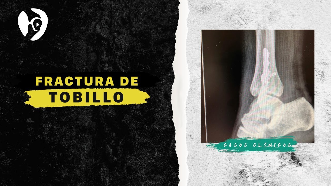 Adrián Gallego Goyanes-36