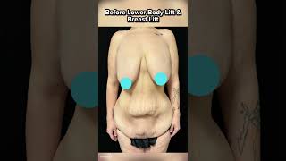 Lampert Md Plastic Surgery