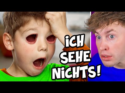 Junge wird PLÖTZLICH BLIND