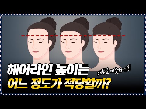 의느님답변????헤어라인 황금비율✍1:1:1 or 0.9:1:1????의미가 없습니다ㅣ다나성형외과(DANA)ㅣ모발이식ㅣ헤어라인교정ㅣ두피문신ㅣ탈모치료