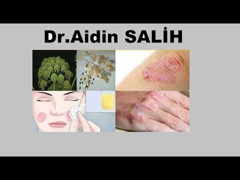 Dr.Aidin SALİH/Vücudumuzdaki Basit Toksinler Egzema İle, Proteinli Atıklar İse Sedef İle Atılır