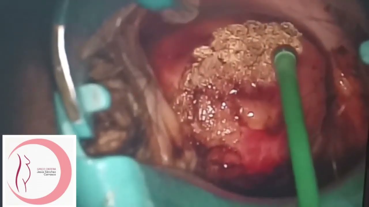 Jesús Sánchez Carrasco-28