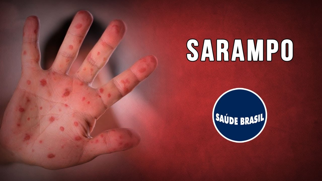 SARAMPO | SÉRIE SAÚDE BRASIL