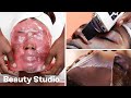 Top 3 Satisfying Facials! Dermaplaning, Cryotherapy and Plaster | Beauty Studio