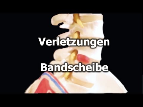 Injektionen für Rückenschmerzen mit Rücken Hernie Twist in den Kniegelenken