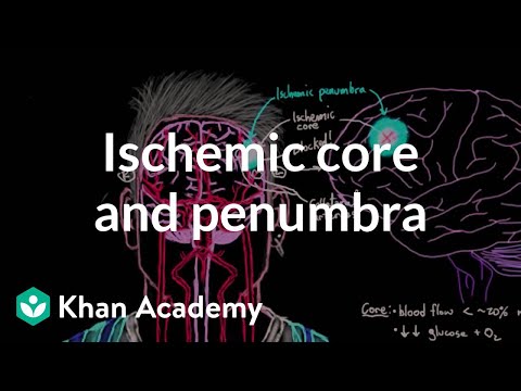 Ischemic core and penumbra | Circulatory System and Disease | NCLEX-RN | Khan Academy