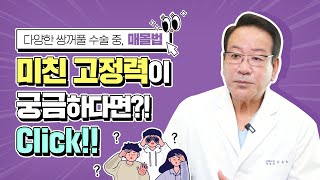 쌍꺼풀 매몰법의 미친 고정력이 궁금하다면?!