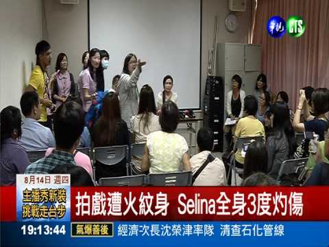 燒傷感同身受 Selina探氣爆傷患