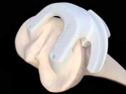 VISIONAIRE - Anwendung