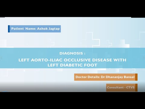Diabetic Foot & Left Aortoiliac Occlusive Disease Treatment | Medicover Pune - Video Thumbnail