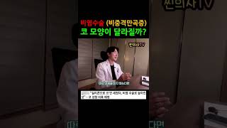 비염수술로 코모양 예뻐질까? #비중격만곡증수술