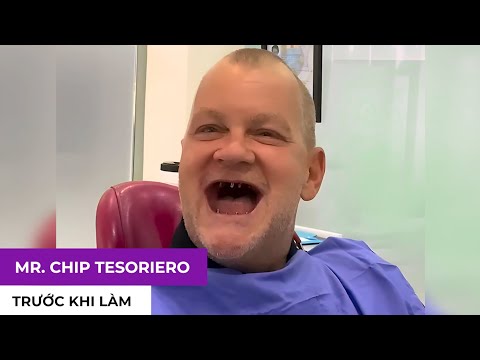 TRỒNG RĂNG IMPLANT CAO CẤP TẠI NHA KHOA CẨM TÚ