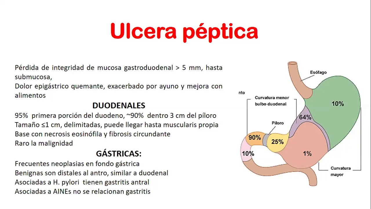 FISIOPATOLOGÍA - Semana 15 - Ulcera Péptica