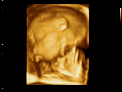 Luisa-Sophia 20.SSW :)