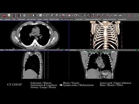 [CT] Chest | Search Pattern