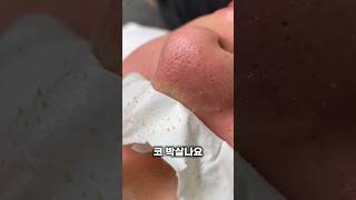 ❌️코 블랙헤드 박살내기 모공 안늘어나❌️ #블랙헤드제거 #블랙헤드 #코피지 #코모공 #여드름압출 #압출영상