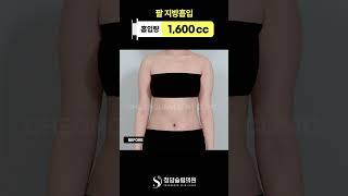 팔 라인… 한달 만에 이렇게 바뀜?