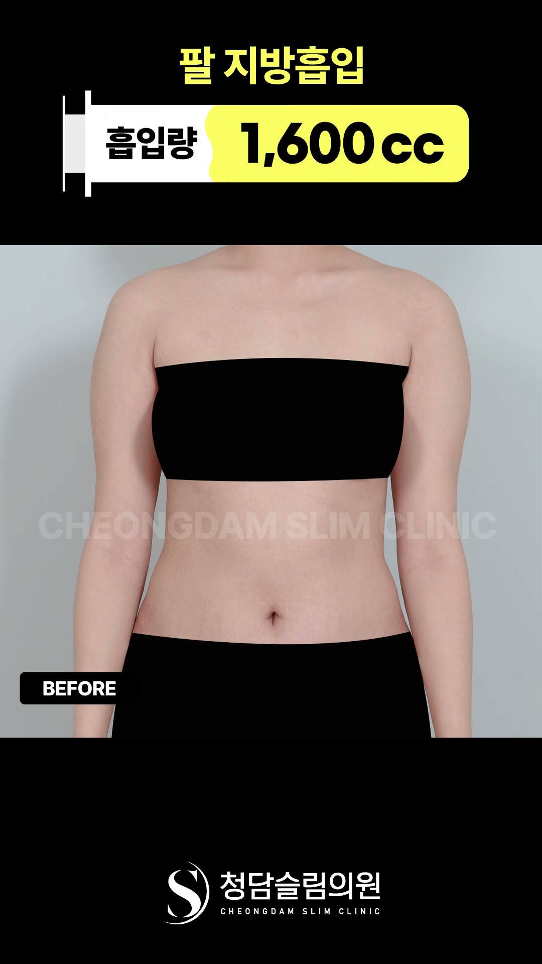 팔 라인… 한달 만에 이렇게 바뀜?