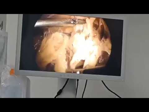 Vivan Bone and Women Care Video
