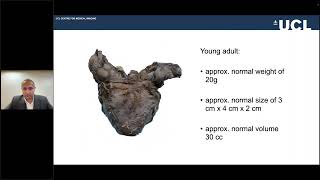 QUIBIM WEBINAR | Enhancing Prostate Cancer Screening  AI, Imaging and Clinical Innovations