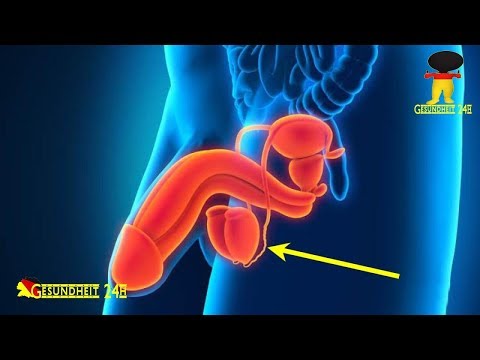 Dass behandelt Prostata bei Männern Prostatakrebs und Potenz Erholung