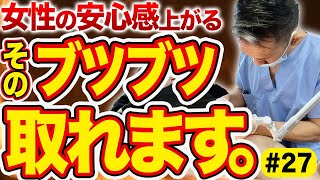 【真珠様小丘疹】ペニスにブツブツ!? 除去手術の全貌を大公開します。