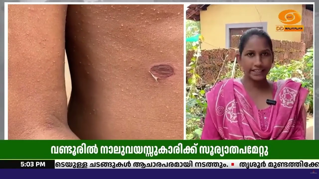 മലപ്പുറത്ത് മുറ്റത്ത് കളിച്ചു കൊണ്ടിരുന്ന നാലുവയസ?