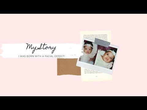 My Story | I Was Born With A Birth Defect
