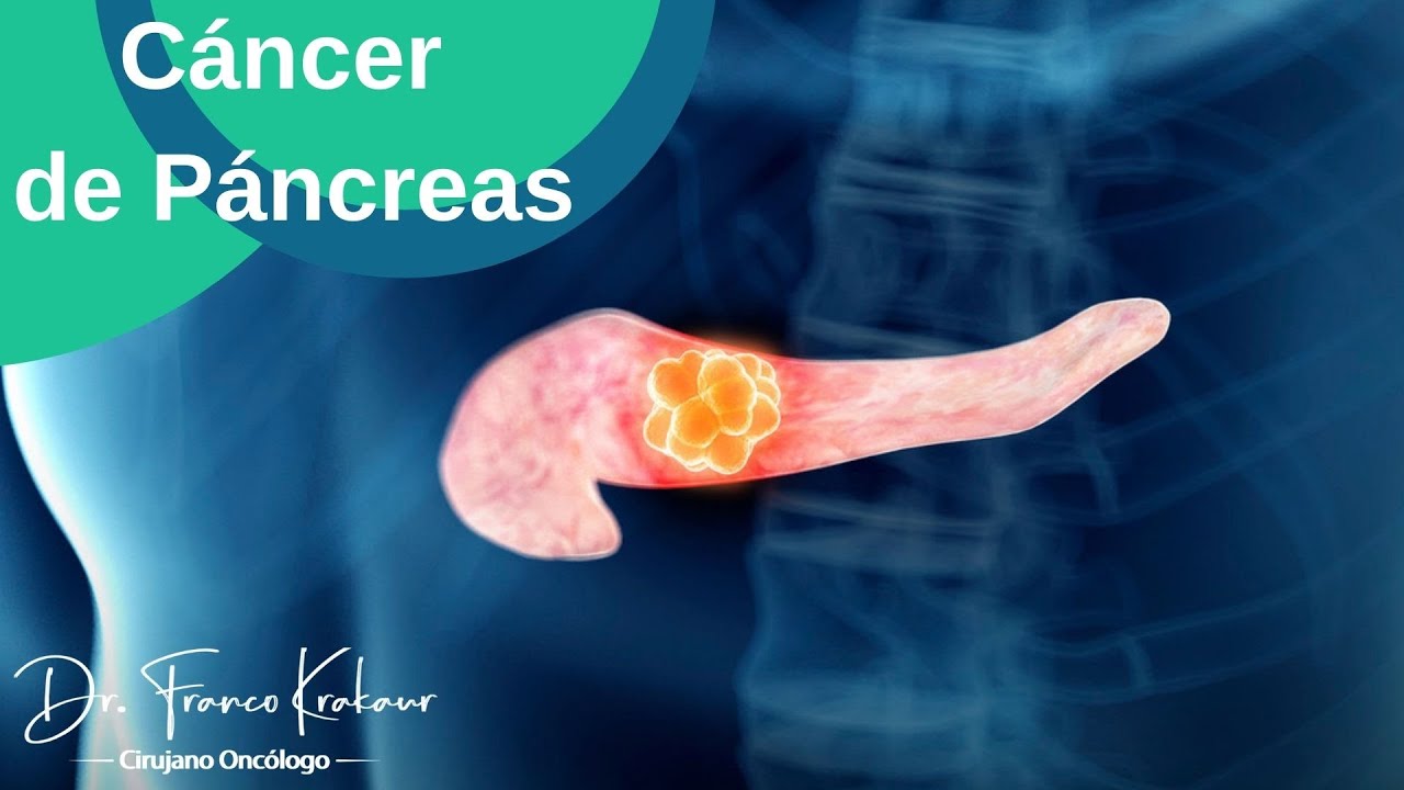 Franco Krakaur García-21