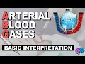 Basic ABG Interpretation Arterial Blood Gases Part 3
