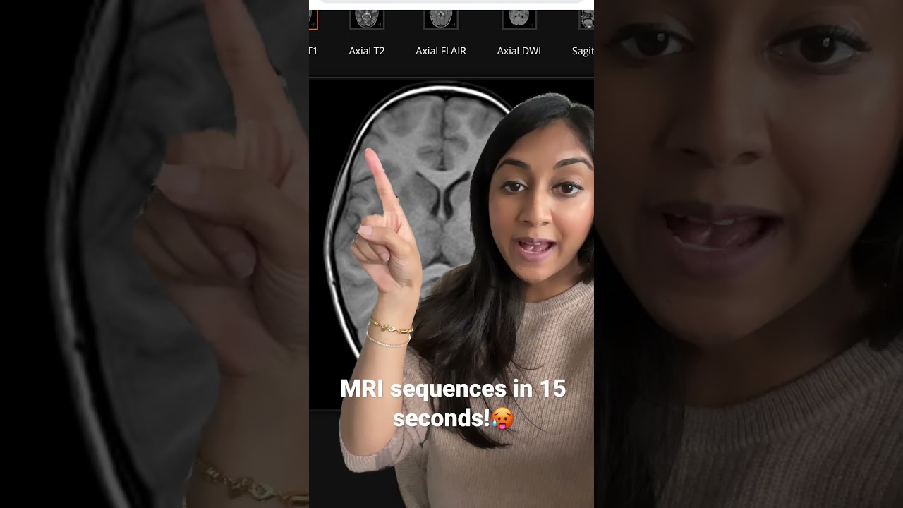 3 workhorse Brain MRI sequences! #shorts #radiology #medschool