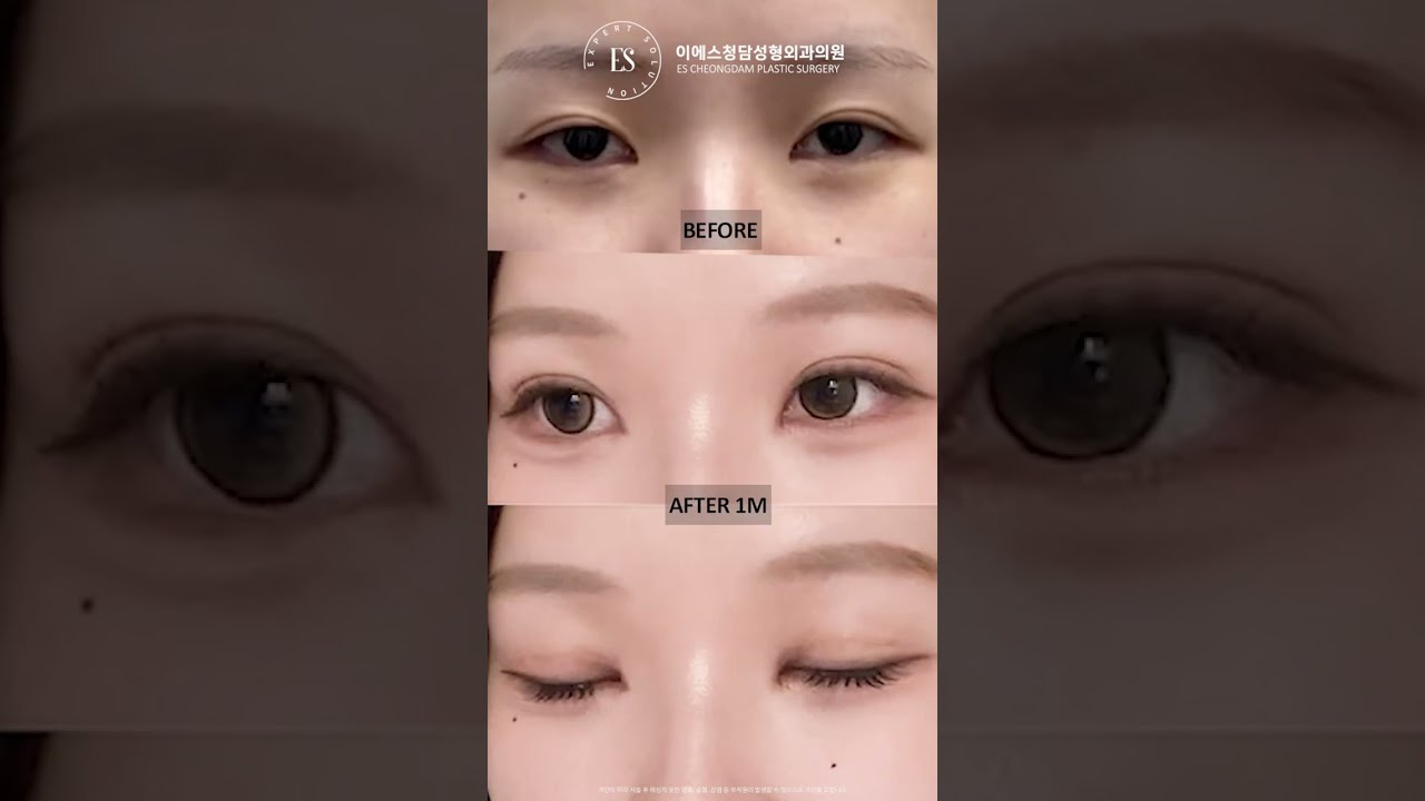 이에스 유튜브