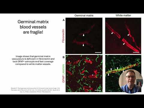 Neuroprotection Care Bundle - Introduction for Medical Trainees