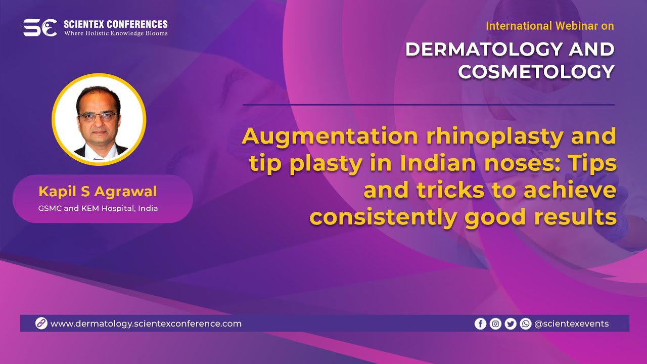 Augmentation rhinoplasty and tip plasty in Indian noses: Tips and tricks to achieve consistently good results