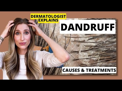 Dermatologist Explains Dandruff: What Causes it & Best...