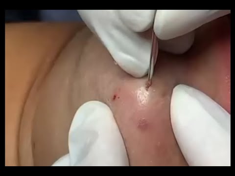 I love these never ending squirty ones!