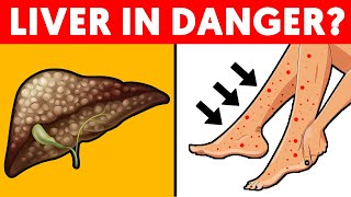 5 Signs of Liver Problems Hidden in Your Feet