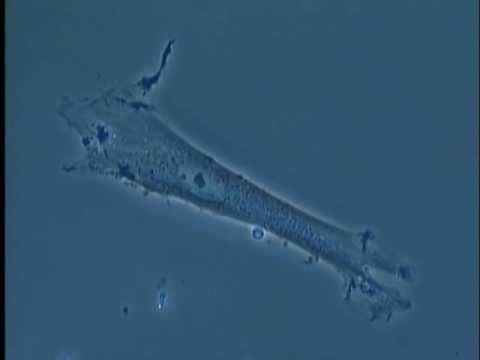 ビイェラ・クルクヴァについて詳しく解説