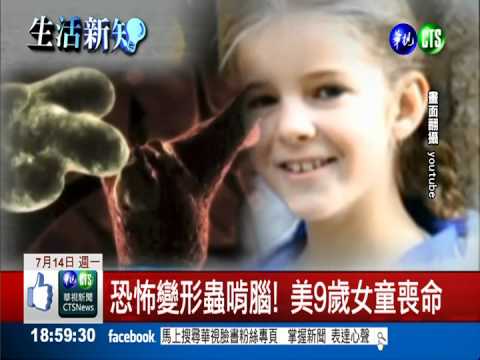 戲水危機! 恐怖變形蟲啃腦奪命