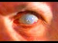 The Tell Tale Heart Best Narration Ever Edgar Alan Poe