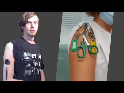 How Can People Actually Believe That People Become Magnetic After A Vaccine?