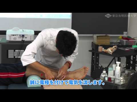 足関節捻挫(ねんざ)のはり治療