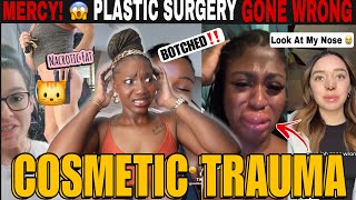 PLASTIC SURGERY GONE WRONG! Botched BBL, Fillers & Cosmetic Trauma Horror Stories | TikTok REACTION