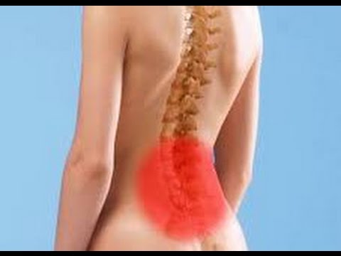Sale sulle articolazioni come affrontarla Trattamento endoscopico per ernie dei dischi intervertebrali