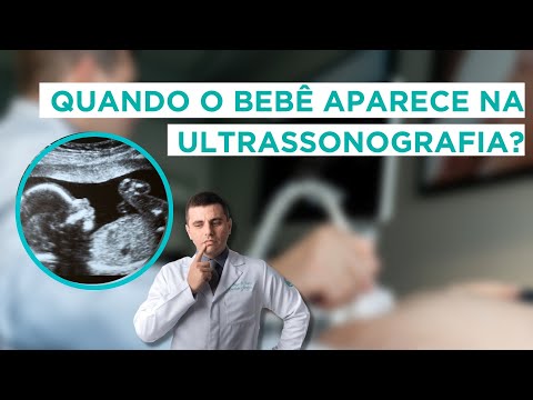 When Does the Baby Appear on the Ultrasound?